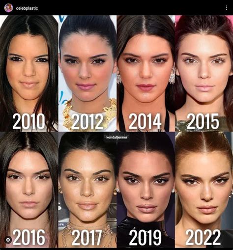 kendall jenner breast|Kendall Jenner Plastic Surgery: Before And After .